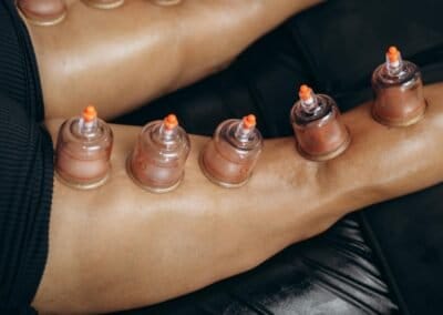 Lichaam cupping massage