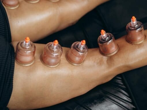 Lichaam cupping massage
